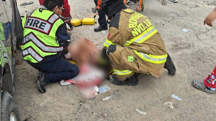 Desgracia en Nuevo Laredo: menores son atropellados en Palmares; niñito sufre grave amputación