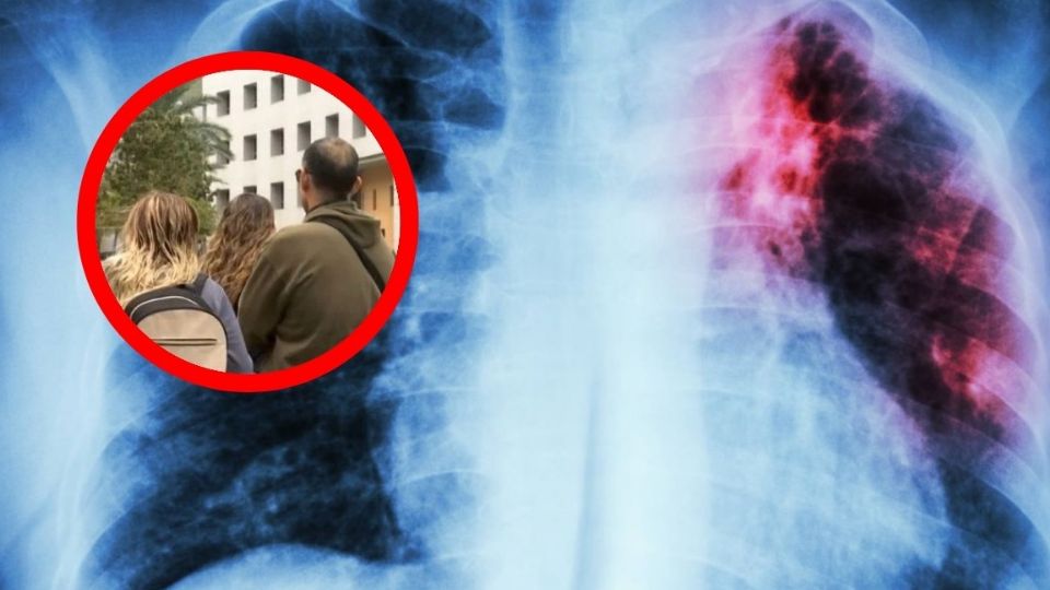 El pequeño tenía los pulmones afectados.