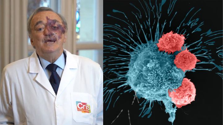 Esperanza real: así funciona el nuevo tratamiento que erradica el cáncer más agresivo de páncreas