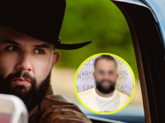 Carín León sorprende a sus fans al someterse a un trasplante capilar