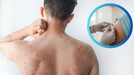 Amplían estrategia contra el sarampión en Tamaulipas; vacunarán a población vulnerable