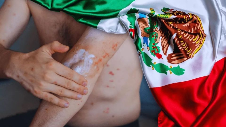 El brote inició en Chihuahua tras los primeros casos detectados ese año