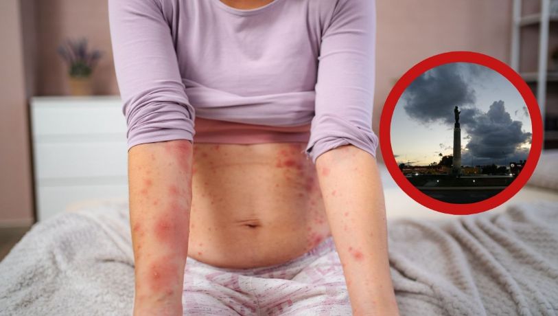 ¿Sarampión en Nuevo Laredo?; autoridades dan versión oficial