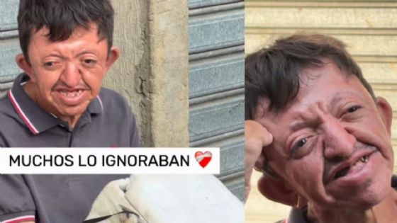 'Todas las noches lloro por mis padres': vendedor ambulante con discapacidad revela su lucha diaria