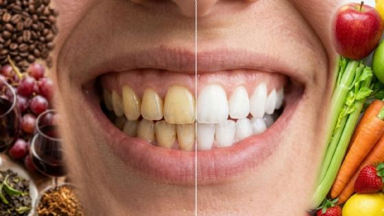 Blanqueamiento natural: ¿Qué alimentos debes comer para tener dientes más claros y esmalte fuerte?