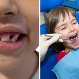 Sufren caries cinco de cada 10 niños en Nuevo Laredo; 7 de 10 presentan gingivitis