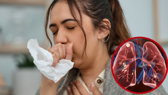 Intensifican vigilancia en Nuevo Laredo por tuberculosis