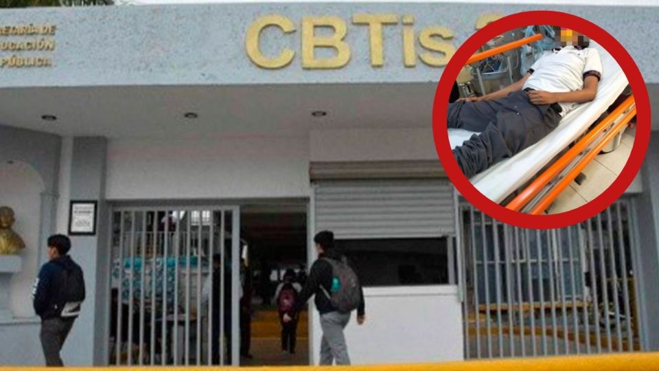 Alumno del CBTis es agredido al salir de clases; ya lo habían amenazado