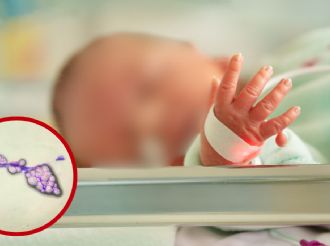 Sífilis congénita golpea a bebés en la frontera de Texas; Laredo registra cifras preocupantes