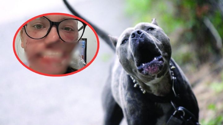 Pitbull ataca violentamente a su dueña mientras sufría una convulsión; le destrozó el rostro