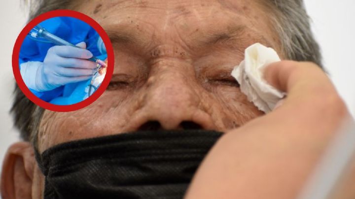 Alistan campaña de cirugías de cataratas en Nuevo Laredo; ¿cuáles son los requisitos?