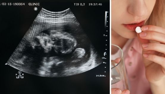 Corte declara inconstitucional castigar el aborto en Tamaulipas