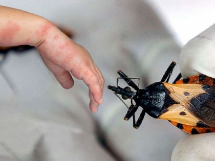 ¿Viste una chinche en tu casa?; este insecto puede provocar una enfermedad silenciosa y mortal