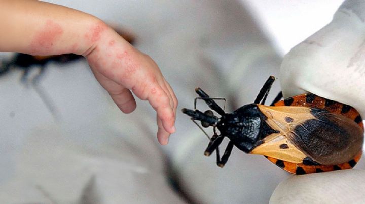 Cuidado con este insecto en tu hogar; la ‘chinche besucona’ puede causar una enfermedad mortal y peligrosa