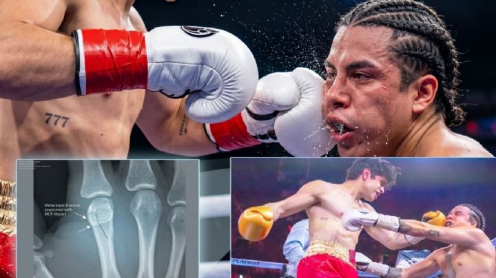 Mario Bautista sufre severa fractura tras ser noqueado por Aaron Mercury en Supernova | VIDEO