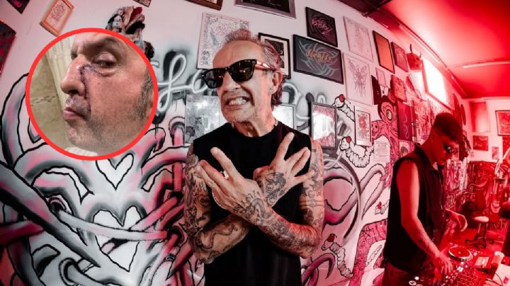 ¿Qué le pasó a Tito Fuentes de Molotov?; confirman que entró a quirófano nuevamente