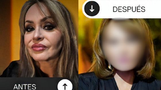 Así luce Gaby Spanic tras su radical cirugía facial; la actriz revela por qué decidió transformarse