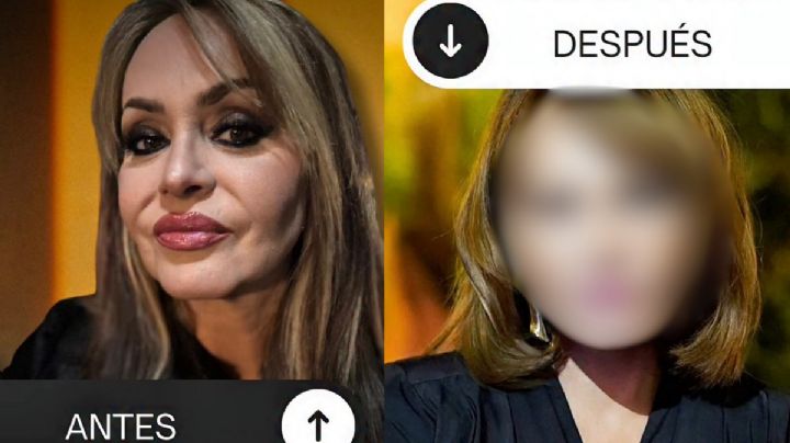 El antes y después de Gaby Spanic tras su radical cirugía estética; la actriz revela qué la llevó al quirófano