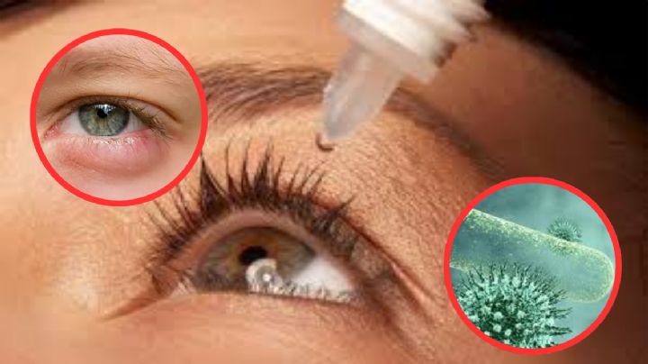 Retiran millones de frascos de gotas para los ojos por falta de esterilidad; podrían empeorar infecciones