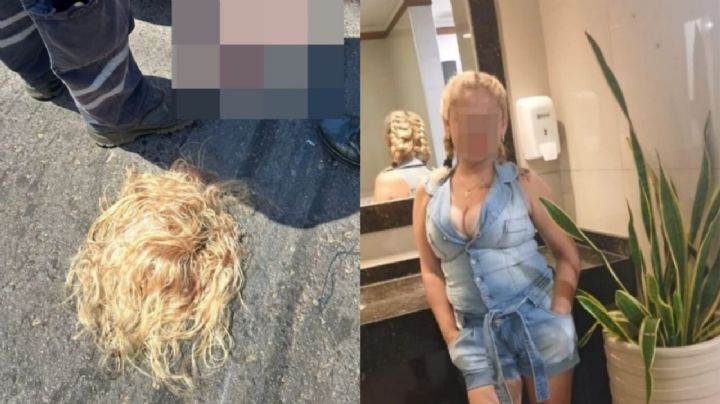 Mujer pierde el cuero cabelludo en brutal accidente; su cabello se enredó en las ruedas de camión urbano | VIDEO